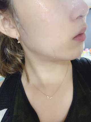 메디타임 멜라반 더마 토닝 씬젤 — 5점을 준 리뷰어가 2019년 6월 올린 사용 사진