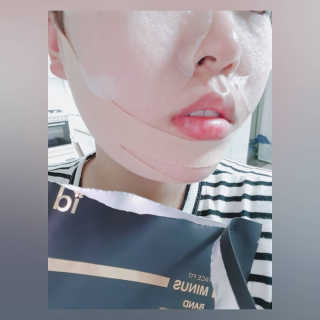 아이디플라코스메틱 아이디 페이스핏 마이너스 밴드 — 5점을 준 리뷰어가 2019년 10월 올린 사용 사진