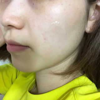 2018 아이소이 잡티세럼 리미티드 컬렉션 — 4점을 준 리뷰어가 2018년 9월 올린 사용 사진