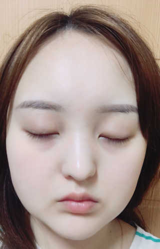 세포랩 바이오제닉 에센스 30ml 특별팩 — 4점을 준 리뷰어가 2018년 5월 올린 사용 사진