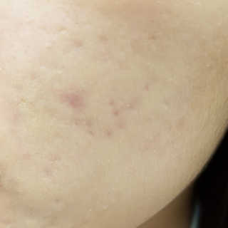 It_Chya님이 올린 리뷰 사진 3