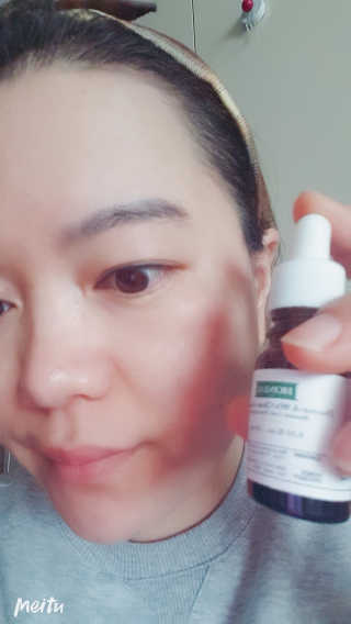어니시 닥터에이 99앰플 세트 10ml X 5개 — 4.5점을 준 리뷰어가 2019년 4월 올린 사용 사진