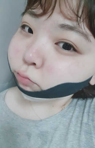 어웨이크어슬립 어슬립 페이스 리프트업 밴드 — 4.5점을 준 리뷰어가 2018년 7월 올린 사용 사진