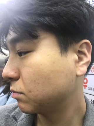 셀라피 에이리페어플러스크림 — 4.67점을 준 리뷰어가 2018년 4월 올린 사용 사진