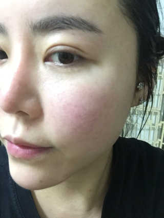23years old 바데카실 오리지널 — 3점을 준 리뷰어가 2018년 2월 올린 사용 사진