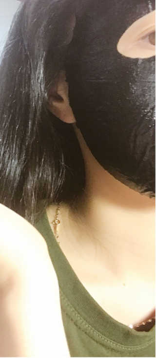 [더마허브] 주사팩 5종, 물광,백옥,태반,신데렐라 등 — 5점을 준 리뷰어가 2018년 3월 올린 사용 사진