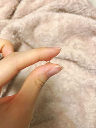 세바메드 클리어 페이스 스팟 컨트롤 젤 — 4점을 준 리뷰어가 2017년 11월 올린 사용 사진