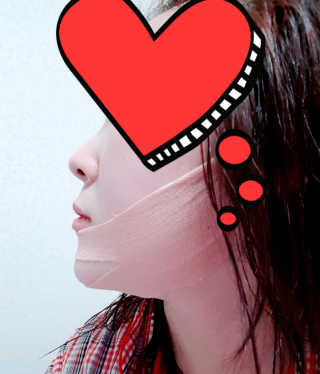 아이디플라코스메틱 아이디 페이스핏 마이너스 밴드 — 5점을 준 리뷰어가 2019년 11월 올린 사용 사진