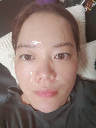 아이디플라코스메틱 아이디 페이스핏 플러스 패치 — 3.5점을 준 리뷰어가 2019년 10월 올린 사용 사진