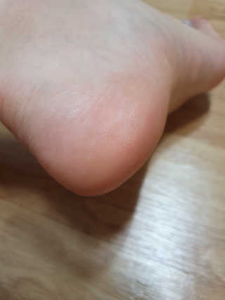 (주)에네스티 에네스티 수안수 실크스킨 풋크림 1+1 — 5점을 준 리뷰어가 2019년 9월 올린 사용 사진