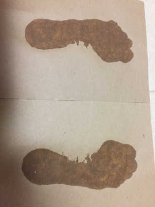 '내 발에 맞춘듯 편안하게’ 에이더 아치서포트 — 5점을 준 리뷰어가 2017년 7월 올린 사용 사진