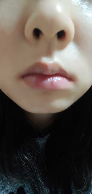 블리스텍스 립 릴리프 크림 립밤, 립 바이브런스 립밤 — 4.67점을 준 리뷰어가 2018년 11월 올린 사용 사진