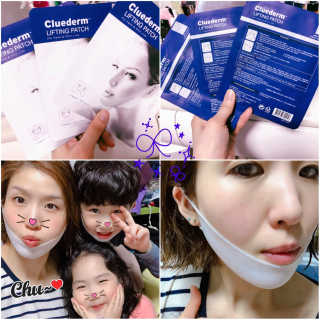 스케덤 클루덤 리프팅 패치 — 5점을 준 리뷰어가 2019년 3월 올린 사용 사진