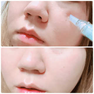 23years old 바데카실 프로 엑스퍼트 앰플 — 5점을 준 리뷰어가 2018년 12월 올린 사용 사진