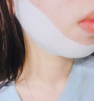 스케덤 클루덤 리프팅 패치 — 4.5점을 준 리뷰어가 2019년 4월 올린 사용 사진