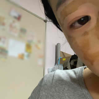 플러스셀라 시카골드 클렌징바 화산재팩 세트 — 4점을 준 리뷰어가 2020년 1월 올린 사용 사진