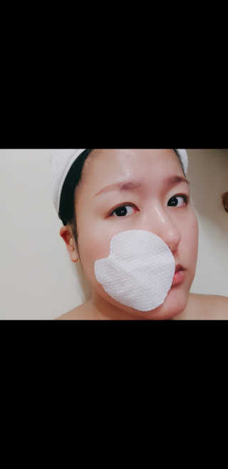 미플레이 진짜 티트리 토너 패드 — 5점을 준 리뷰어가 2018년 11월 올린 사용 사진