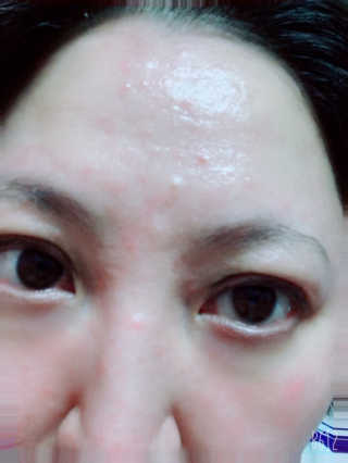 뷰티여우_아토클리닉 [아토클리닉] 아기들이 쓰는 보습, 진정 수딩젤 2개 — 5점을 준 리뷰어가 2019년 7월 올린 사용 사진