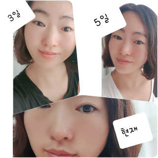 러블리앤님이 올린 리뷰 사진 4