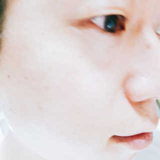메디페르루테인앰플 3종 — 5점을 준 리뷰어가 2019년 9월 올린 사용 사진