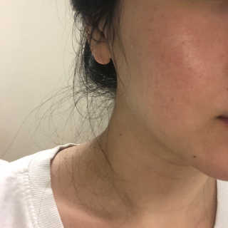 23years old 바데카실 P-오리지널 — 4.17점을 준 리뷰어가 2018년 6월 올린 사용 사진