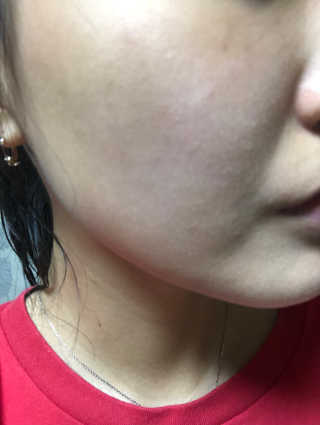 온가족 수분뿜뿜 노랑뚜껑 재주꾼 와우374 스네일토너 — 4점을 준 리뷰어가 2019년 9월 올린 사용 사진