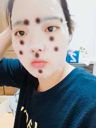 메디힐 바이오포인트 서클포인트마스크 3종 — 4.5점을 준 리뷰어가 2017년 5월 올린 사용 사진