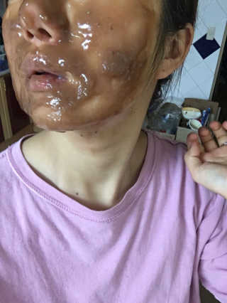 23years old 카카오 에너지 모델링 마스크 — 4점을 준 리뷰어가 2017년 4월 올린 사용 사진