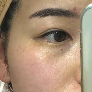 셀라피 에이리페어플러스크림 — 3점을 준 리뷰어가 2018년 4월 올린 사용 사진