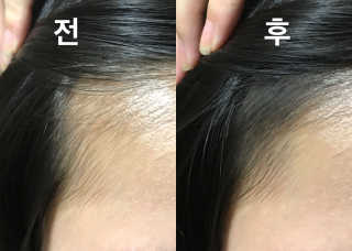 다슈코리아 다슈 안티 헤어로스 헤어쿠션 16g — 4.83점을 준 리뷰어가 2017년 9월 올린 사용 사진