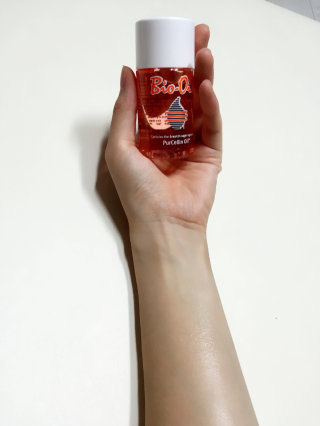 Bio-oil(바이오오일) 바이오오일(Bio-oil) — 5점을 준 리뷰어가 2016년 8월 올린 사용 사진