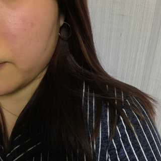 Dr.메디션 리턴 화이트닝 스팟 크림- 달마시안크림 — 4.67점을 준 리뷰어가 2018년 11월 올린 사용 사진