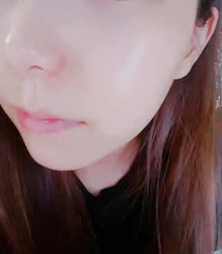 일동제약 퍼스트랩 프로바이오틱 수딩 젤 크림 — 5점을 준 리뷰어가 2018년 9월 올린 사용 사진