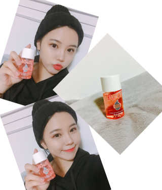 Bio-oil(바이오오일) 바이오오일(Bio-oil) — 3.5점을 준 리뷰어가 2017년 1월 올린 사용 사진