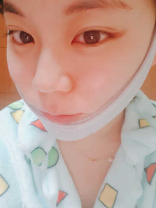 메디미 브이미 업 2스텝 브이라인벨트 — 5점을 준 리뷰어가 2017년 12월 올린 사용 사진