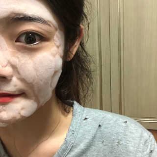 셀퓨전씨 트리악 포어 딜리트 버블 팩 — 3점을 준 리뷰어가 2018년 7월 올린 사용 사진