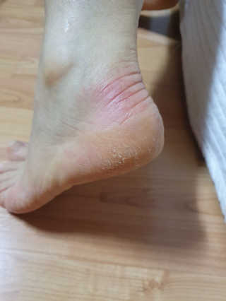(주)에네스티 에네스티 수안수 실크스킨 풋크림 1+1 — 4점을 준 리뷰어가 2019년 11월 올린 사용 사진