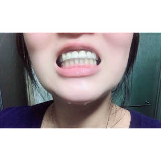 the naked object 디블랙팩치약 디블랙칫솔 세트 — 5점을 준 리뷰어가 2019년 1월 올린 사용 사진