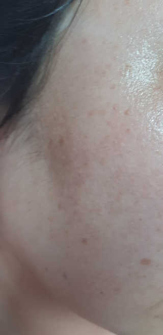 온가족 수분뿜뿜 노랑뚜껑 재주꾼 와우374 스네일토너 — 4.5점을 준 리뷰어가 2019년 9월 올린 사용 사진