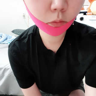 스케덤 펩타이드 리프팅밴드 — 4점을 준 리뷰어가 2019년 6월 올린 사용 사진