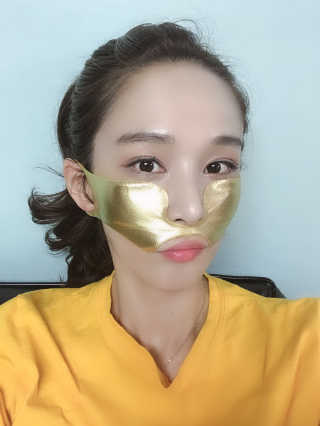 [스케덤] 상악밴드 — 4.5점을 준 리뷰어가 2019년 5월 올린 사용 사진