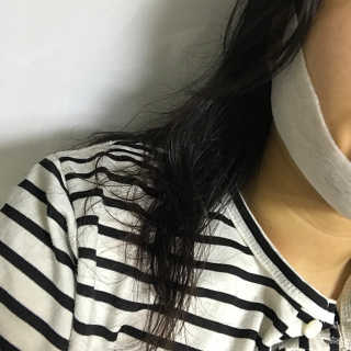 스케덤 클루덤 리프팅 패치 — 4점을 준 리뷰어가 2019년 3월 올린 사용 사진