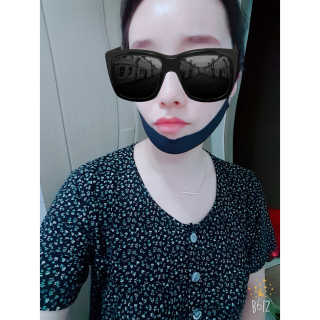 어웨이크어슬립 어슬립 페이스 리프트업 밴드 — 5점을 준 리뷰어가 2018년 7월 올린 사용 사진