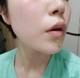 이지함 메디컬러 핑크원 블루원 그린원 — 4점을 준 리뷰어가 2019년 5월 올린 사용 사진