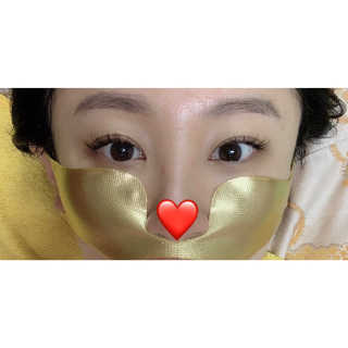 [스케덤] 상악밴드 — 3.5점을 준 리뷰어가 2019년 6월 올린 사용 사진