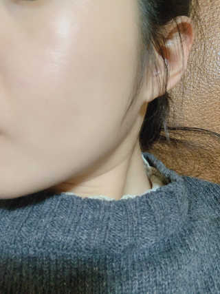 닥터웰메이드원 압구지엔 다이아몬드 링거앰플 — 5점을 준 리뷰어가 2018년 12월 올린 사용 사진