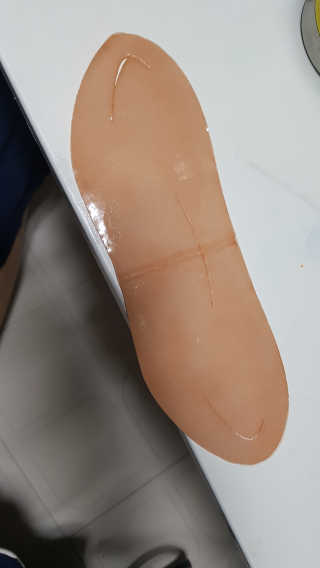 아이디플라코스메틱 아이디 페이스핏 마이너스 밴드 — 3점을 준 리뷰어가 2019년 12월 올린 사용 사진