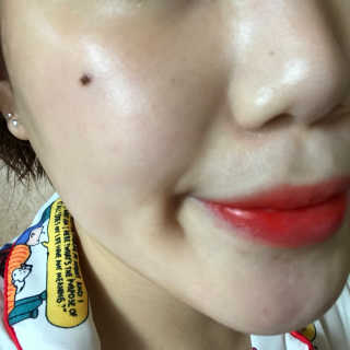 23years old 바데카실 세라3 플러스 — 5점을 준 리뷰어가 2018년 8월 올린 사용 사진