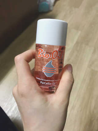 Bio-oil(바이오오일) 바이오오일(Bio-oil) — 4.5점을 준 리뷰어가 2017년 1월 올린 사용 사진