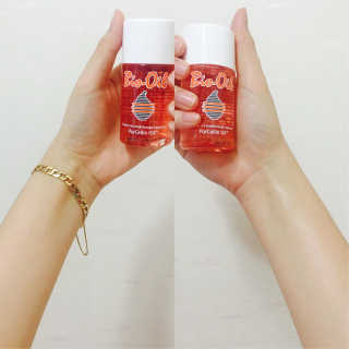 Bio-oil(바이오오일) 바이오오일(Bio-oil) — 4.5점을 준 리뷰어가 2017년 1월 올린 사용 사진
